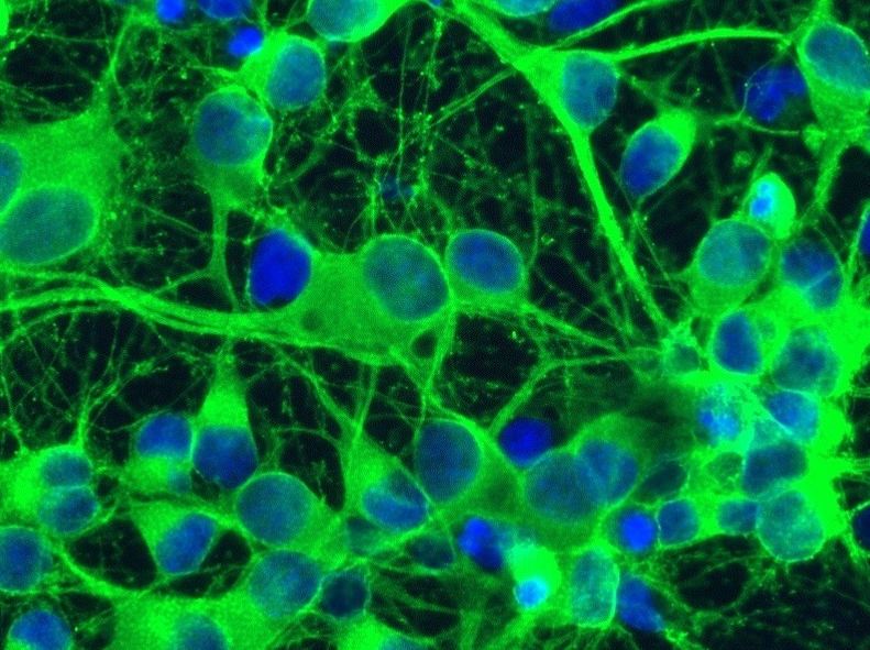 digitally enhanced photo of neurons